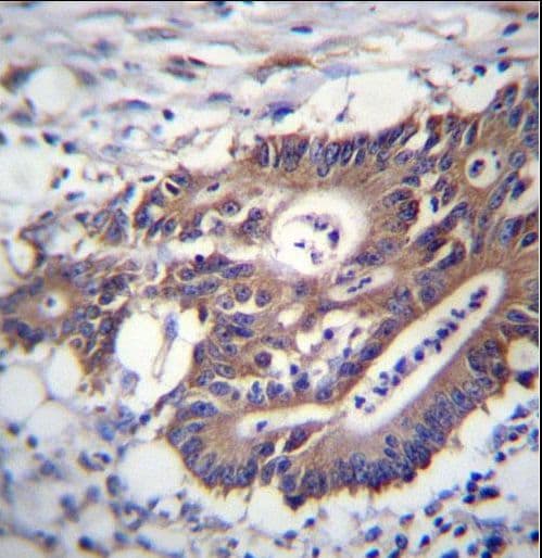 Polyclonal Rabbit anti-Human KRT12 / CK12 / Cytokeratin 12 Antibody (aa442-471, IHC, WB)