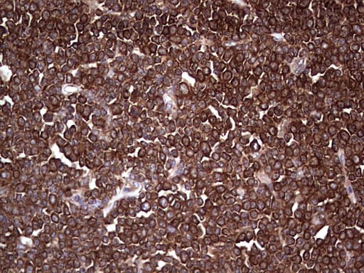 PKM2 Antibody (clone 1G10)