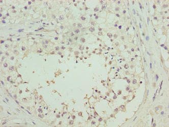 Polyclonal Rabbit anti-Human C8orf51 Antibody (IHC)