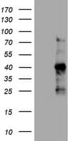 MKI67 / Ki67 Antibody (clone OTI9F12)