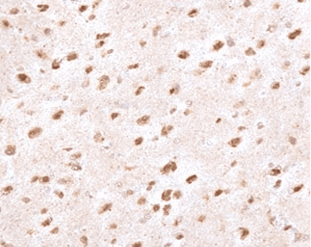 Ubiquitin Antibody (clone PBQN-1, Azide-free, BSA-free)