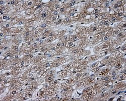 DAPK2 / DAP Kinase 2 Antibody (clone OTI1C5, Carrier-free)