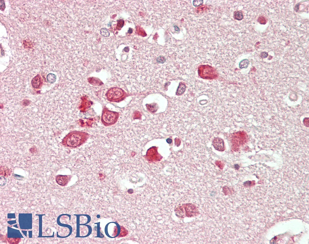 IHC-plus™ NBEA / Neurobeachin Antibody (aa2934-2946)