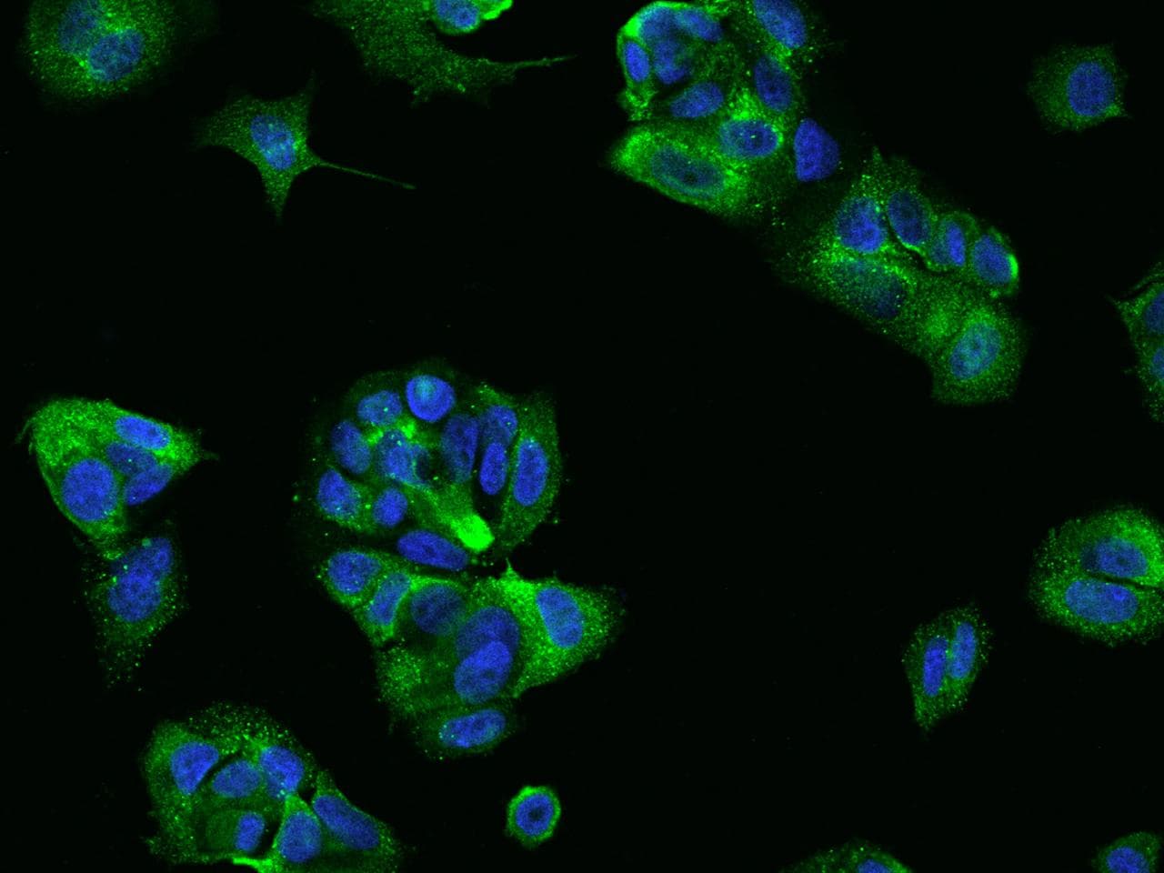 CLDN7 / Claudin 7 Antibody