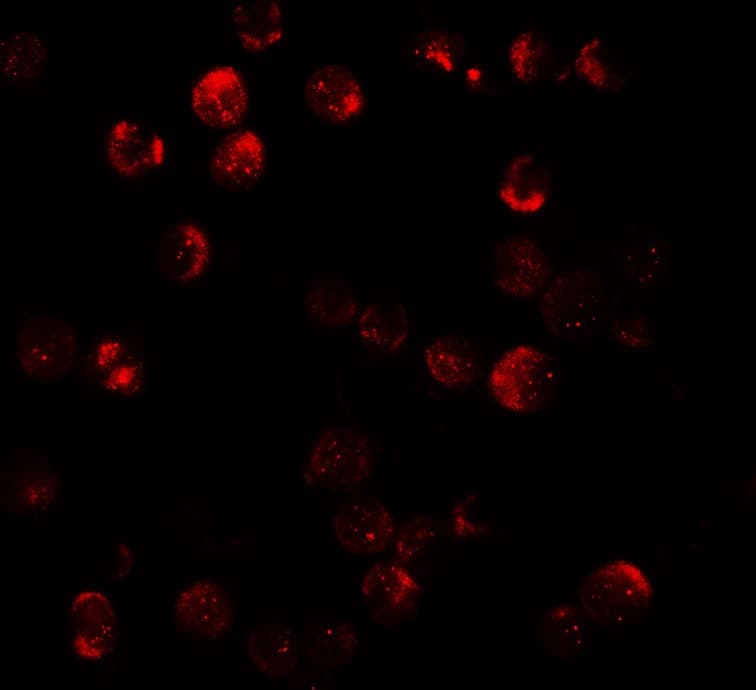 IHC-plus™ Polyclonal Rabbit anti-Human DNM1L / DRP1 Antibody (IHC, IF, WB)