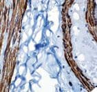Monoclonal Mouse anti-Human ACTA2 / Smooth Muscle Actin Antibody (Ready-to-Use, IHC)