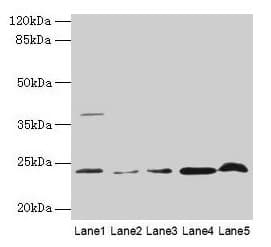 CRYBA1 Antibody
