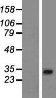 AP1AR Protein (Over-Expression Lysate Myc-DDK (Flag))