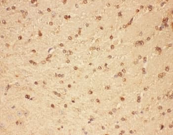 Polyclonal Rabbit anti-Mouse CNTF Antibody (aa2-198, IHC, WB)