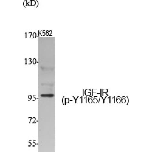 IGF1R / IGF1 Receptor Antibody (1100-1180 aa)