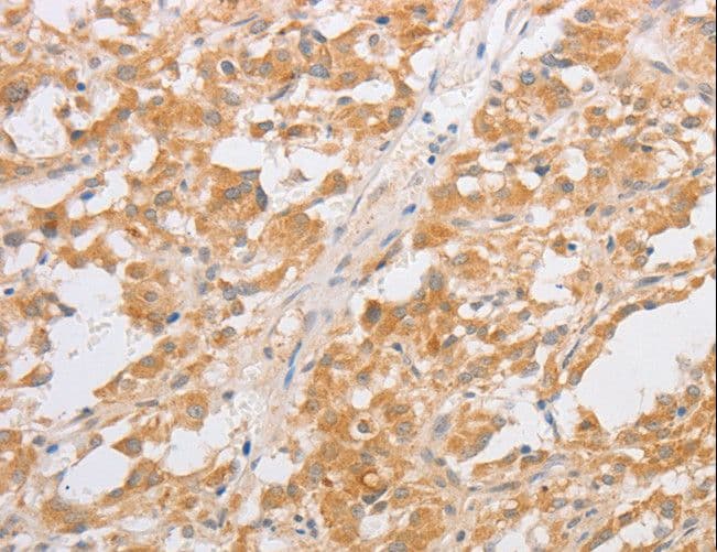 CDKN2AIP Antibody