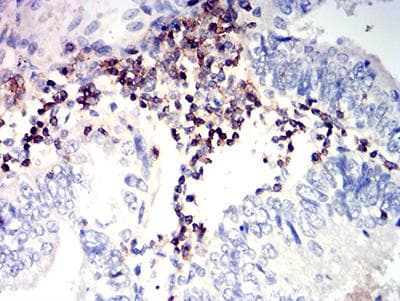 SLAMF6 / NTBA Antibody (clone 2F1C9)