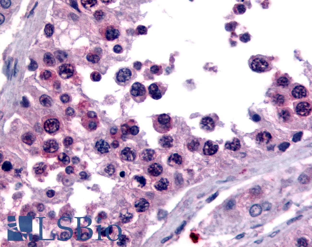 IHC-plus™ SPECC1 / CYTSB Antibody (aa1-100)