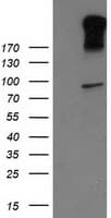 GPR49 / LGR5 Antibody (aa250-550, clone OTI2A2)
