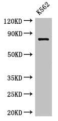 IHC-plus™ IL12RB1 / CD212 Antibody