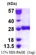 Human GSTM3 Protein (Recombinant His)