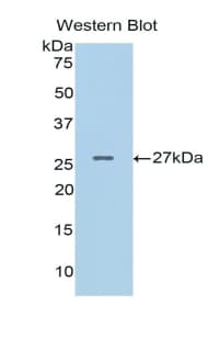 PAPPA / PAPP-A Antibody (aa317-532)