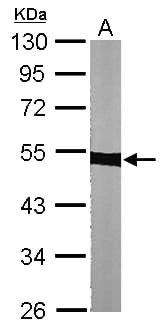 Polyclonal Rabbit anti-Human Alpha Tubulin Antibody (aa118-365, IHC, WB)