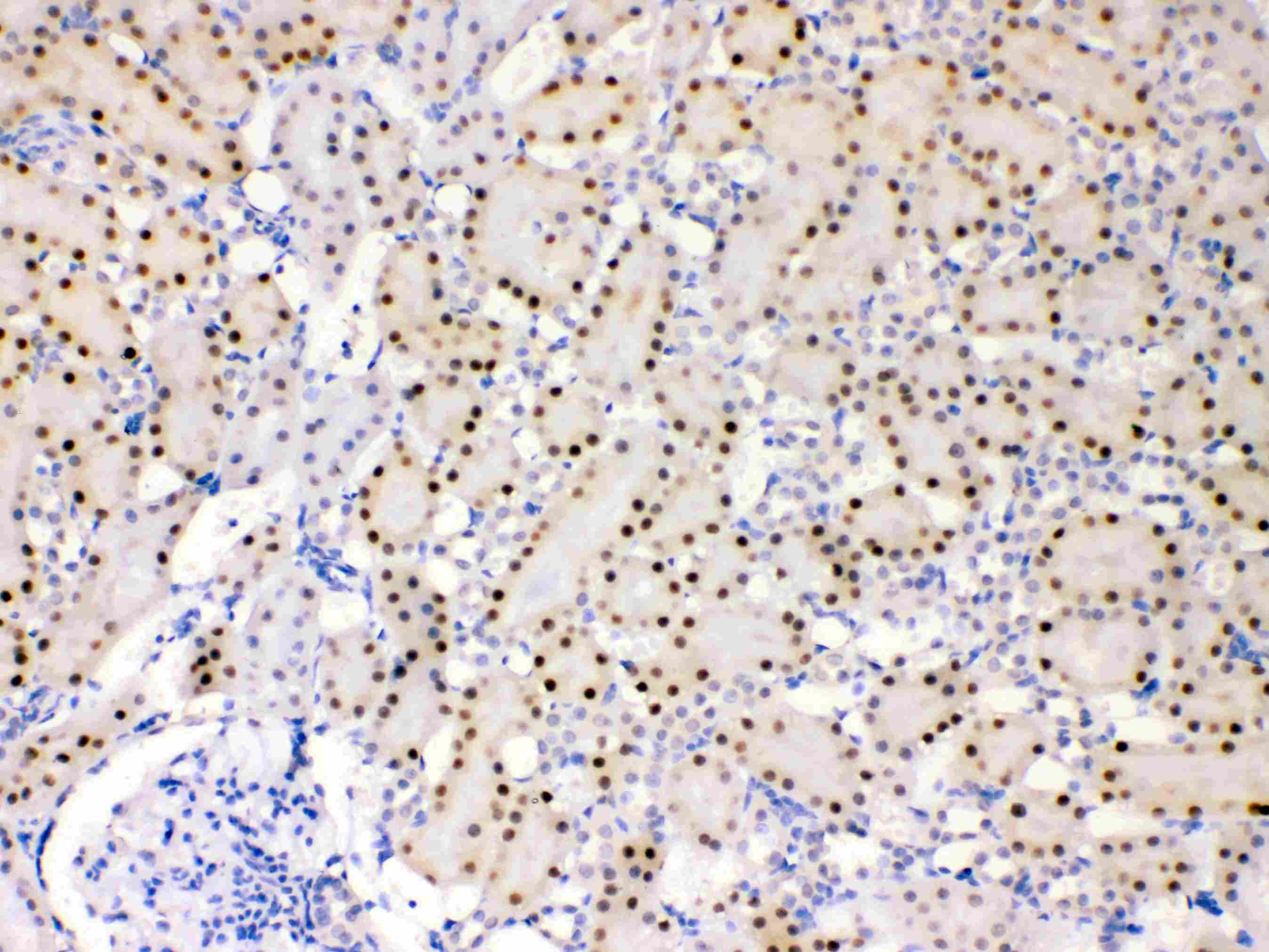 Polyclonal Rabbit anti-Human ADK / Adenosine Kinase Antibody (IHC, WB)
