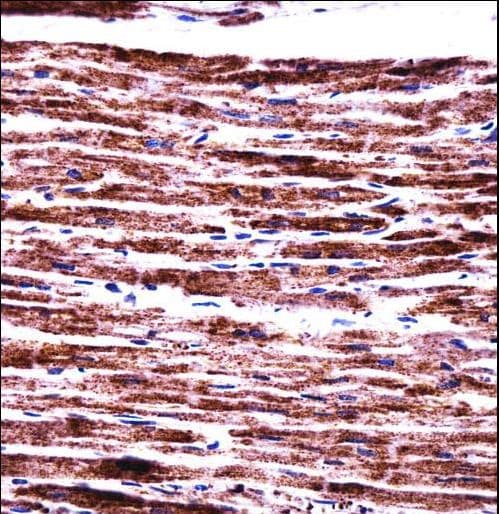 PERP Antibody (aa162-191)
