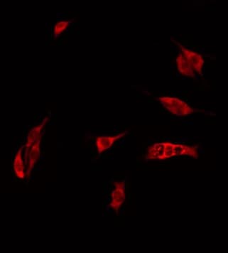 CEACAM21 Antibody