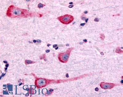 IHC-plus™ Polyclonal Rabbit anti-Human DRD2 / Dopamine Receptor D2 Antibody (Cytoplasmic Domain, IHC)