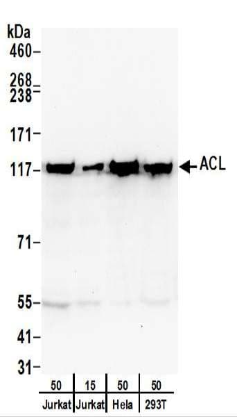 IHC-plus™ ACLY / ATP Citrate Lyase Antibody (aa350-400)