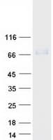 Human RYK Protein (Recombinant Myc-DDK (Flag))