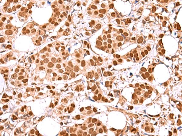 RCOR3 Antibody