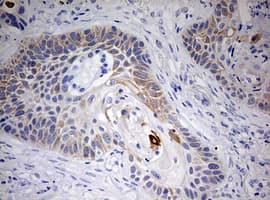 Monoclonal Mouse anti-Human KRT20 / CK20 / Cytokeratin 20 Antibody (clone OTI3G1, IHC, WB)