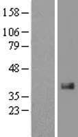 CTGF Protein (Over-Expression Lysate Myc-DDK (Flag))
