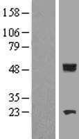 CYP11B1 Protein (Over-Expression Lysate Myc-DDK (Flag))
