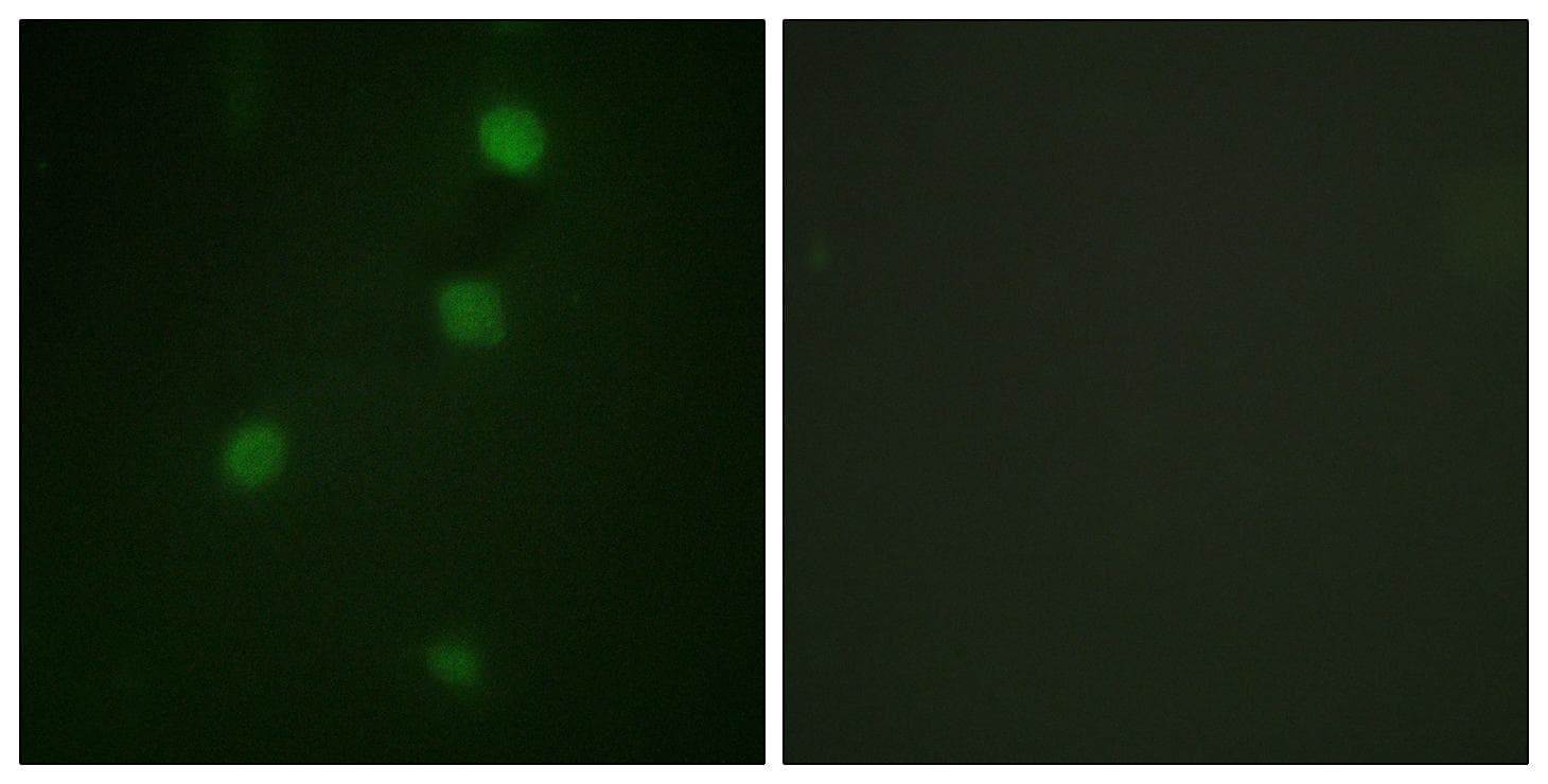 RB1 / Retinoblastoma / RB Antibody