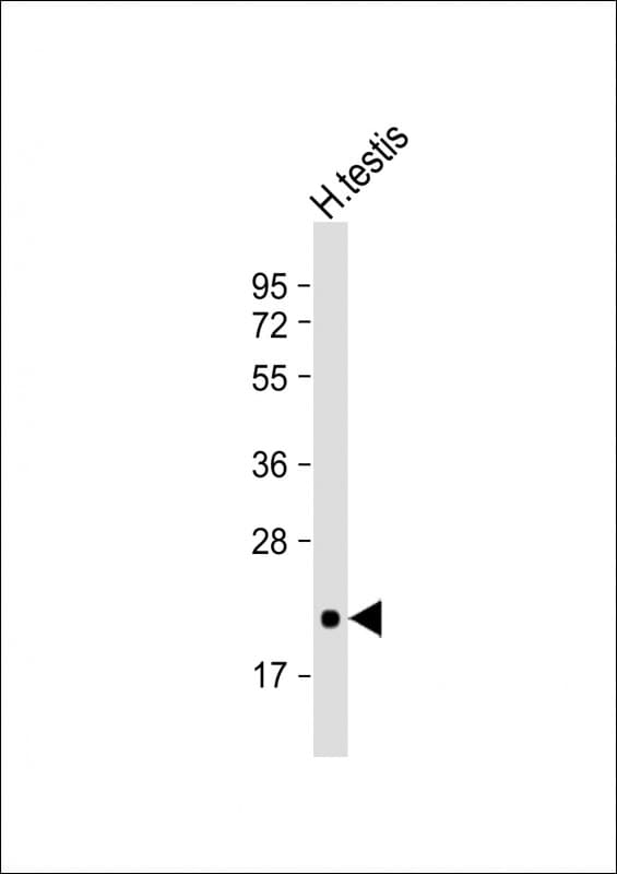 CD81 Antibody (clone 1668CT270.93.9)