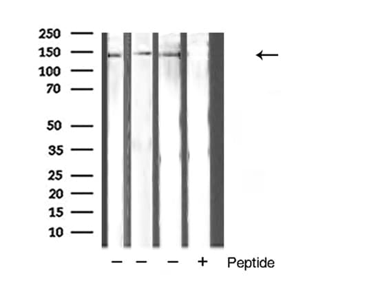 Hamartin / TSC1 Antibody