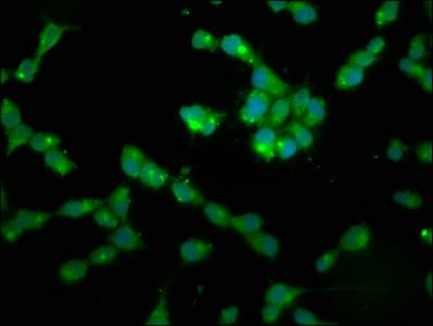 PPP2R2B Antibody