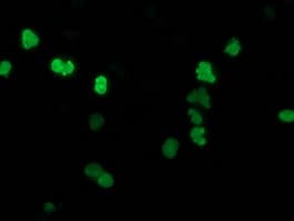 SSX1 Antibody (clone OTI2G5)