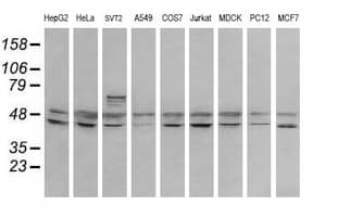 RNF39 Antibody (clone OTI5E10, Carrier-free)