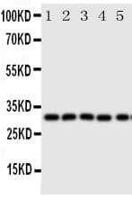 AQP9 / Aquaporin 9 Antibody (aa263-278)