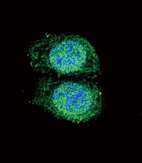 BCL2 / Bcl-2 Antibody (aa75-110)