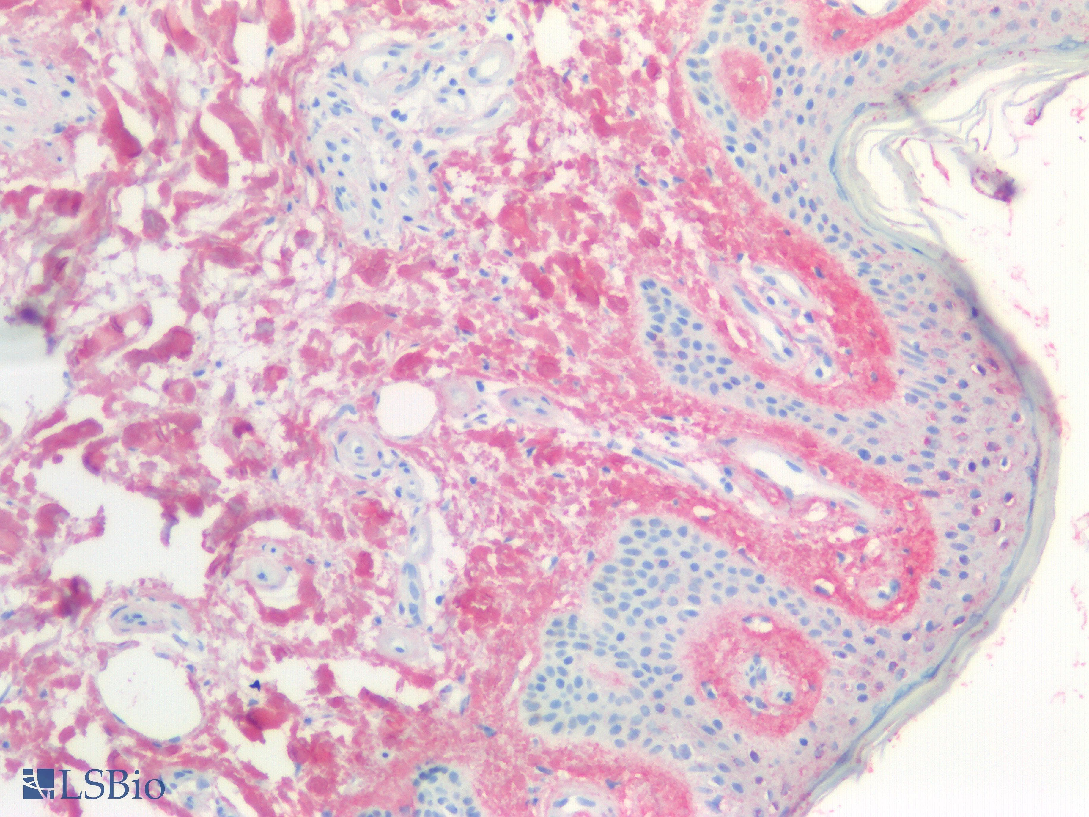 PathPlus™ NTx-I Antibody