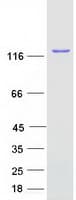 Human SART3 Protein (Recombinant Myc-DDK (Flag))