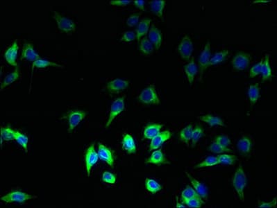 Polyclonal Rabbit anti-Human HLA-DRB1 Antibody (aa30-266, WB)