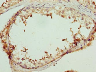 LRRC18 Antibody