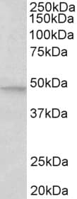 IHC-plus™ MAPK9 / JNK2 Antibody (aa217-230)