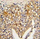 Polyclonal Rabbit anti-Human Lumican Antibody (aa64-91, IHC, WB)