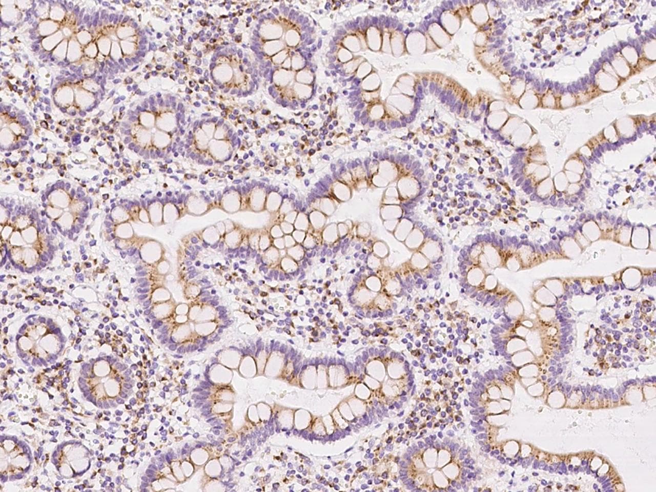 GNPTG Antibody