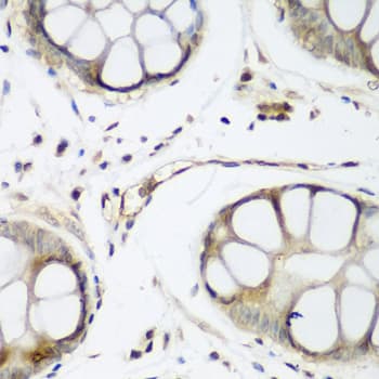 IHC-plus™ WWTR1 / TAZ Antibody