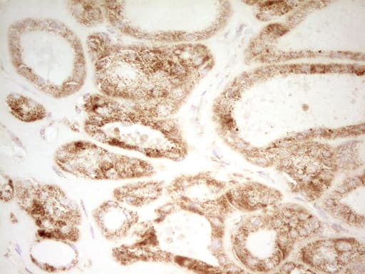 Monoclonal Mouse anti-Human MRRF Antibody (clone OTI1D5, aa56-262, IHC, WB)