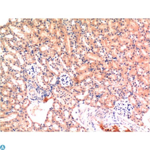 Monoclonal Mouse anti-Human BAX Antibody (IHC, WB)